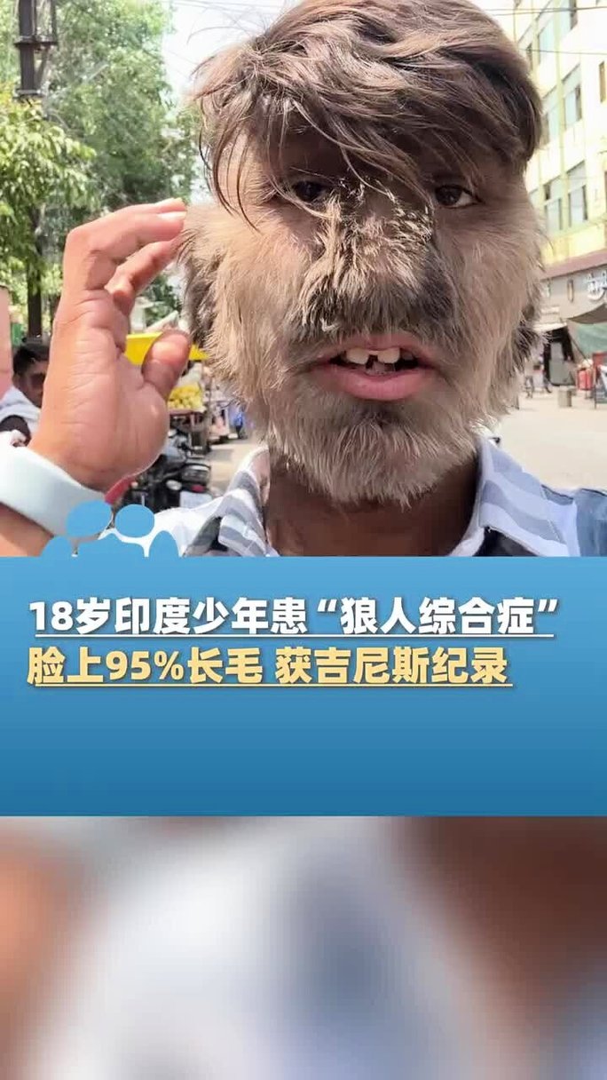 少妇av一区免费看的相关介绍